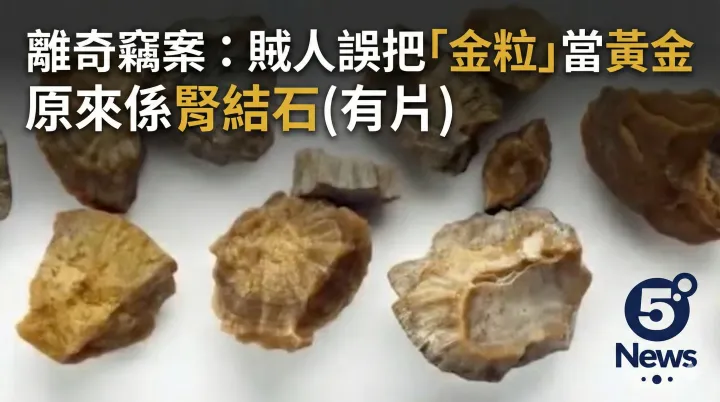 離奇竊案：賊人誤把「金粒」當黃金 原來係腎結石(有片)